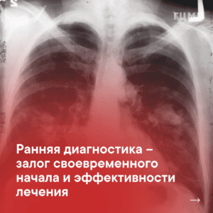 26 мая -2 июля — Неделя профилактики Рака легких